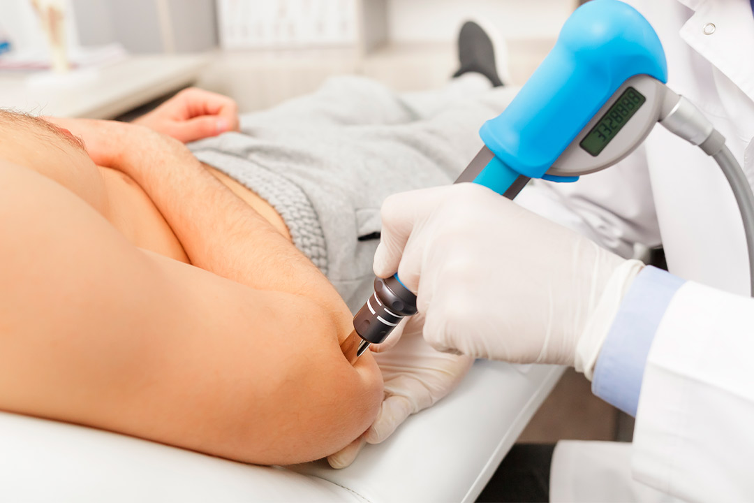A man undergoing a shockwave therapy in his arm aimed at alleviating golf elbow pain.