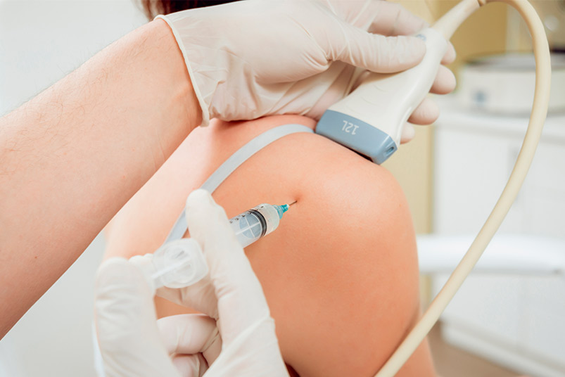 Individual getting an arm injection, related to studies showing improved recovery for shoulder and elbow with Shockwave and PRP.
