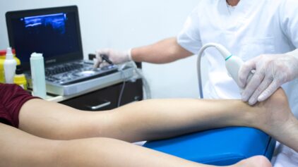 The Ultimate Guide to Maximizing ESWT Results in Tendinopathy Management