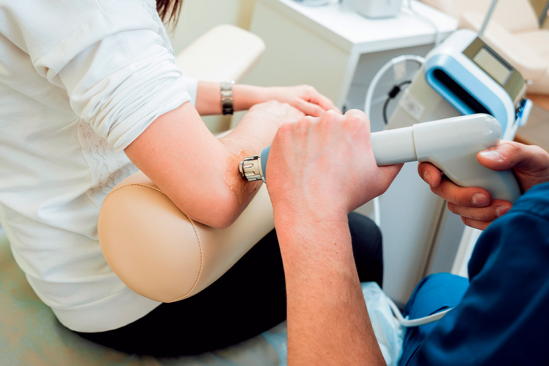 shockwave therapy over elbow