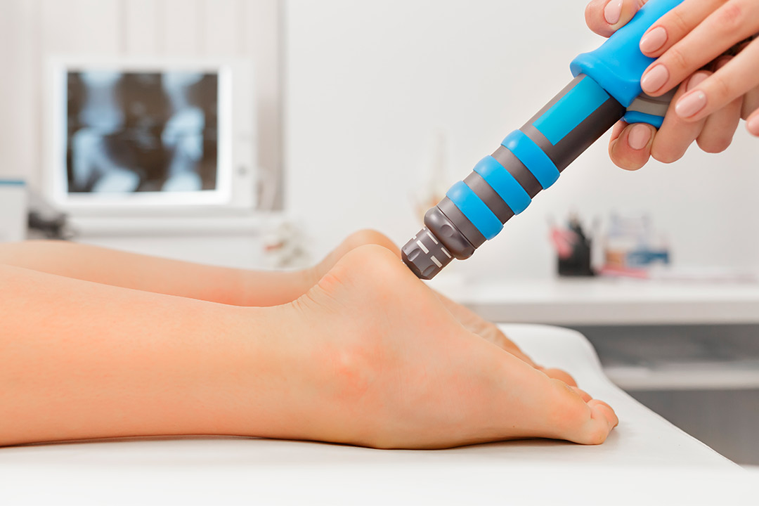 A person’s foot is positioned next to shoes, emphasizing how ESWT is transforming plantar fasciitis treatment in beach settings.