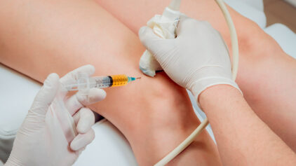 Clinical Evidence is Growing: PRP + Shockwave Outperforms Solo Treatments