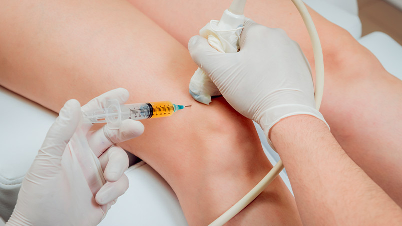 Clinical Evidence is Growing: PRP + Shockwave Outperforms Solo Treatments