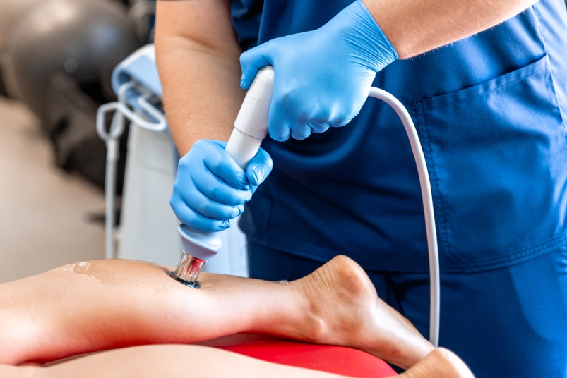 Physical therapy of the shin with shock wave, extracorporeal shockwave therapy.